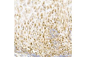 Immunohistochemistry of paraffin-embedded human esophagus using MDH2 Rabbit mAb (ABIN7268381) at dilution of 1:25 (40x lens).