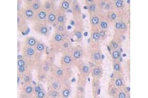 IHC-P analysis of Rat Tissue, with DAB staining. (Periostin antibody  (AA 24-173))