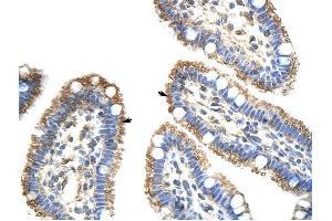 FZD9 antibody was used for immunohistochemistry at a concentration of 4-8 ug/ml to stain Epithelial cells of intestinal villus (arrows) in Human Intestine. (FZD9 antibody)