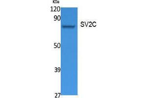 Western Blotting (WB) image for anti-Synaptic Vesicle Glycoprotein 2C (SV2C) (Internal Region) antibody (ABIN3178108) (SV2C antibody  (Internal Region))