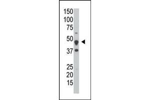 Image no. 1 for anti-Dual Specificity Phosphatase 6 (DUSP6) (Middle Region) antibody (ABIN360781) (DUSP6 antibody  (Middle Region))