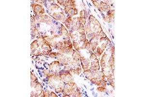 Immunohistochemical analysis of paraffin-embedded H. (MATN2 antibody  (AA 732-760))
