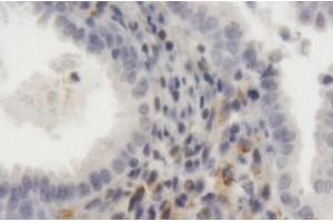 Immunoperoxidase of purified MaxPab antibody to LRP1 on formalin-fixed paraffin-embedded human endometrium. (LRP1 antibody  (AA 1-292))