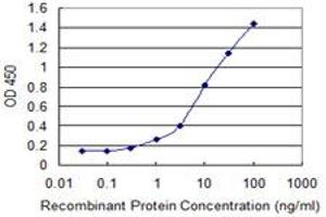 Detection limit for recombinant GST tagged ADNP is 0. (ADNP antibody  (AA 1018-1102))