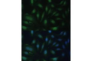 Immunofluorescence analysis of U-2 OS cells using p27 KIP 1 antibody (ABIN3020889, ABIN3020890, ABIN3020891 and ABIN6213779) at dilution of 1:100. (CDKN1B antibody  (AA 1-198))