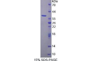 Image no. 1 for Torsin Family 1, Member A (Torsin A) (TOR1A) (AA 33-321) protein (His tag) (ABIN4990586) (TOR1A Protein (AA 33-321) (His tag))