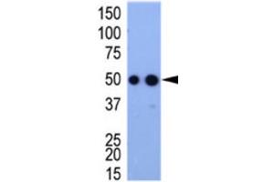 Western Blotting (WB) image for anti-HA-Tag antibody (ABIN2932102) (HA-Tag antibody)