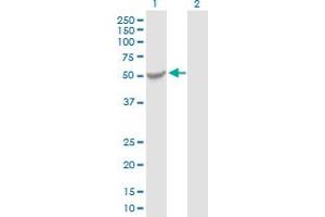 Western Blot analysis of KATNAL2 expression in transfected 293T cell line by KATNAL2 MaxPab polyclonal antibody. (KATNAL2 antibody  (AA 1-466))