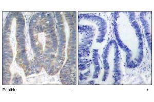 Image no. 1 for anti-Eukaryotic Translation Initiation Factor 2-alpha Kinase 2 (EIF2AK2) (Thr451) antibody (ABIN197555) (EIF2AK2 antibody  (Thr451))