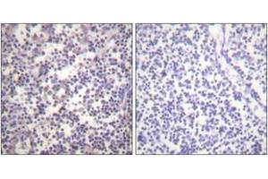 Immunohistochemistry analysis of paraffin-embedded human lymph node, using B-RAF (Phospho-Ser602) Antibody. (SNRPE antibody  (pSer602))