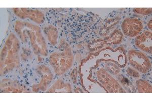 Detection of OPN in Human Kidney Tissue using Polyclonal Antibody to Osteopontin (OPN) (Osteopontin antibody  (AA 18-314))