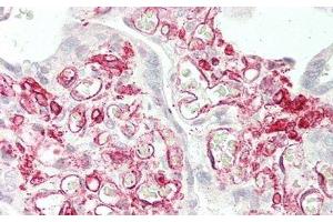 Detection of CD32 in Human Placenta Tissue using Polyclonal Antibody to Cluster Of Differentiation 32 (CD32) (Fc gamma RII (CD32) (AA 69-309) antibody)