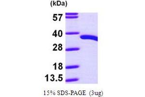SDS-PAGE (SDS) image for Pyridoxal (Pyridoxine, Vitamin B6) Phosphatase (PDXP) (AA 1-296) protein (His tag) (ABIN667804) (PDXP Protein (AA 1-296) (His tag))