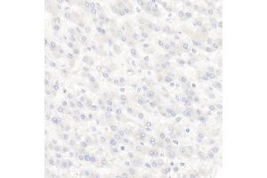 Immunohistochemistry of paraffin-embedded Human liver using TROP-2 antibody (ABIN7271103) at dilution of 1:2700 (40x lens). (TACSTD2 antibody)