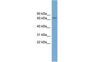 Image no. 1 for anti-Protein Kinase C, eta (PRKCH) (AA 35-84) antibody (ABIN6746461) (PKC eta antibody  (AA 35-84))