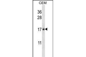IL21 Antibody (C-term) (ABIN657761 and ABIN2846740) western blot analysis in CEM cell line lysates (35 μg/lane). (IL-21 antibody  (C-Term))