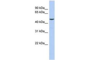 Image no. 1 for anti-Friend Leukemia Virus Integration 1 (FLI1) (AA 35-84) antibody (ABIN6744400) (FLI1 antibody  (AA 35-84))