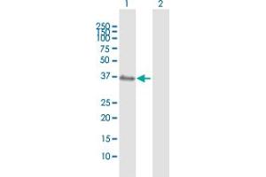 Western Blot analysis of XPA expression in transfected 293T cell line by XPA MaxPab polyclonal antibody. (XPA antibody  (AA 1-273))
