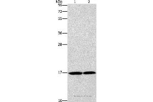 Western blot analysis of Mouse heart and human fetal brain tissue, using GMFG Polyclonal Antibody at dilution of 1:1142 (GMFG antibody)