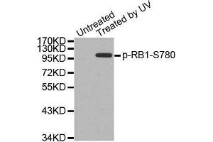 Western blot analysis of extracts from 3T3 cells, using Phospho-RB1-S780 antibody.