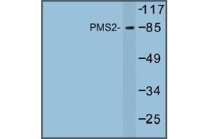Image no. 1 for anti-PMS2 Postmeiotic Segregation Increased 2 (S. Cerevisiae) (PMS2) antibody (ABIN317683) (PMS2 antibody)