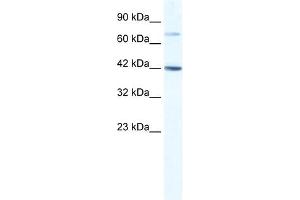 WB Suggested Anti-GLI4 Antibody Titration:  1. (GLI4 antibody  (N-Term))
