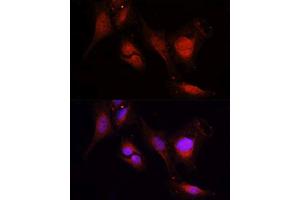 Immunofluorescence (IF) image for anti-Matrix Metalloproteinase 2 (MMP2) (AA 40-280) antibody (ABIN6143911)