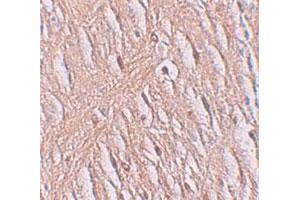 Immunohistochemical staining of human brain cells with SLC39A9 polyclonal antibody  at 2. (SLC39A9 antibody  (N-Term))