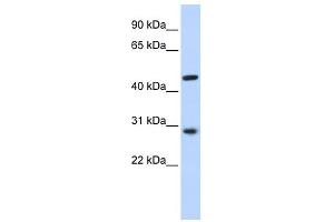 WB Suggested Anti-PYGO2 Antibody Titration:  0.