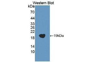 Detection of Recombinant COTL1, Human using Polyclonal Antibody to Coactosin Like Protein 1 (COTL1) (COTL1 antibody  (AA 1-142))