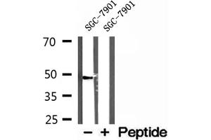 Western blot analysis of extracts of SGC-7901 cells, using L2HGDH antibody. (L2HGDH antibody  (Internal Region))