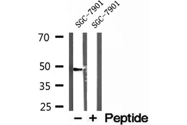 L2HGDH antibody  (Internal Region)
