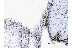 Immunohistochemistry (IHC) image for anti-High Mobility Group Box 1 (HMGB1) (AA 124-154), (C-Term) antibody (ABIN5518759)