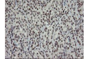 Image no. 1 for anti-Transducin-Like Enhancer of Split 1 (E(sp1) Homolog, Drosophila) (TLE1) (AA 180-460) antibody (ABIN1491050) (TLE1 antibody  (AA 180-460))