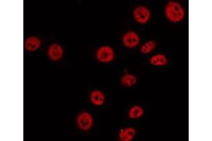 ABIN6274880 staining 293 by IF/ICC. (ABCA6 antibody  (Internal Region))