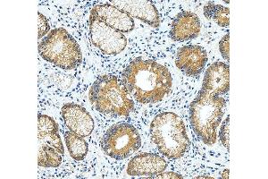 IHC analysis of RASAL1 using anti-RASAL1 antibody (ABIN6719367). (RASAL1 antibody  (AA 721-798))