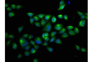 Immunofluorescence staining of Hela cells with ABIN7174520 at 1:66, counter-stained with DAPI. (UBA1 antibody  (AA 730-881))