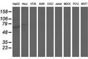 Western blot analysis of extracts (35 µg) from 9 different cell lines by using anti-ARHGAP25 monoclonal antibody. (ARHGAP25 antibody)