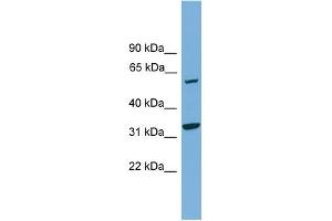 WB Suggested Anti-XPNPEP3 Antibody Titration: 0. (XPNPEP3 antibody  (N-Term))
