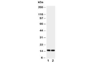 Western blot testing of FABP5 antibody and Lane 1:  rat liver (FABP5 antibody  (AA 10-23))