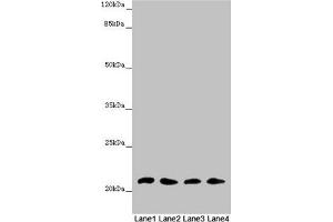 Western blot All lanes: MSRB3 antibody at 4. (MSRB3 antibody  (AA 1-185))
