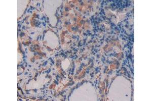 Used in DAB staining on fromalin fixed paraffin- embedded thyroid tissue (CD164 antibody  (AA 24-162))