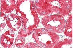 Human Kidney: Formalin-Fixed, Paraffin-Embedded (FFPE)