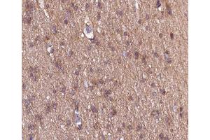 ABIN6266533 at 1/100 staining human brain tissue sections by IHC-P. (COL18A1 antibody  (C-Term))
