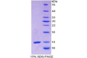 SDS-PAGE analysis of Human Olfactomedin 4 Protein. (Olfactomedin 4 Protein (OLFM4))