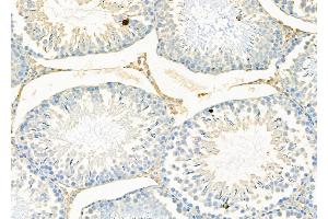 ABIN6263801 and ABIN6276975 at 1/100 staining Rat testis tissue by IHC-P.