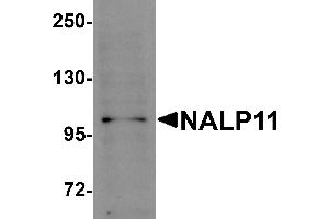 Western Blotting (WB) image for anti-NLR Family, Pyrin Domain Containing 11 (NLRP11) (C-Term) antibody (ABIN1030531) (NLRP11 antibody  (C-Term))
