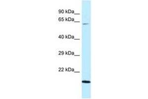Image no. 1 for anti-DnaJ (Hsp40) Homolog, Subfamily C, Member 11 (DNAJC11) (AA 407-456) antibody (ABIN6747790) (DNAJC11 antibody  (AA 407-456))