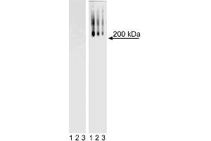Western Blot analysis of TRA-1-60 in mouse and human ES cell lines. (TRA1-60 antibody)