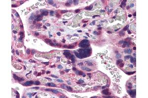 Anti-CAND1 antibody IHC of human placenta. (CAND1 antibody  (C-Term))